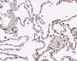 Invitrogen ABI2 Recombinant Rabbit Monoclonal Antibody (JE53-89) 100 &mu;L;