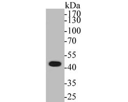 Invitrogen ABI2 Recombinant Rabbit Monoclonal Antibody (JE53-89) 100 &mu;L;