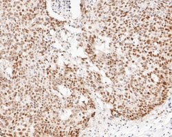Invitrogen DP1 Recombinant Rabbit Monoclonal Antibody (JE52-55) 100 &mu;L;