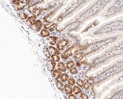 Invitrogen DP1 Recombinant Rabbit Monoclonal Antibody (JE52-55) 100 &mu;L;