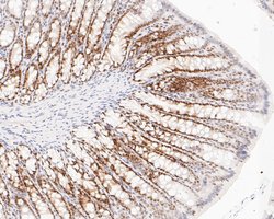 Invitrogen DP1 Recombinant Rabbit Monoclonal Antibody (JE52-55) 100 &mu;L;