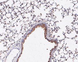 Invitrogen ARF5 Recombinant Rabbit Monoclonal Antibody (JE53-83) 100 &mu;L;
