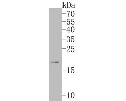 Invitrogen ARF5 Recombinant Rabbit Monoclonal Antibody (JE53-83) 100 &mu;L;