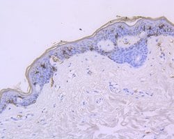 Invitrogen CD1a Recombinant Rabbit Monoclonal Antibody (JE28-74) 100 &mu;L;