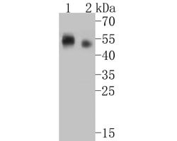 Invitrogen CD1a Recombinant Rabbit Monoclonal Antibody (JE28-74) 100 &mu;L;