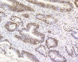 Invitrogen MSH2 Recombinant Rabbit Monoclonal Antibody (JE28-48) 100 &mu;L;