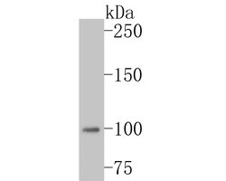 Invitrogen MSH2 Recombinant Rabbit Monoclonal Antibody (JE28-48) 100 &mu;L;