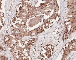 Invitrogen MGMT Recombinant Rabbit Monoclonal Antibody (JE31-37) 100 &mu;L;