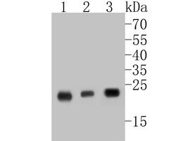 Invitrogen MGMT Recombinant Rabbit Monoclonal Antibody (JE31-37) 100 &mu;L;