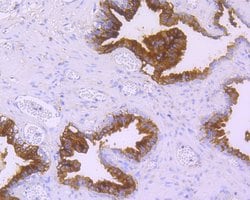 Invitrogen CD38 Recombinant Rabbit Monoclonal Antibody (JE29-35) 100 &mu;L;