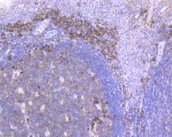Invitrogen CD38 Recombinant Rabbit Monoclonal Antibody (JE29-35) 100 &mu;L;