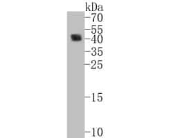 Invitrogen CD38 Recombinant Rabbit Monoclonal Antibody (JE29-35) 100 &mu;L;
