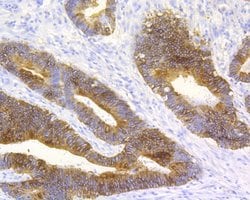 Invitrogen Cytokeratin 20 Recombinant Rabbit Monoclonal Antibody (JE20-39)