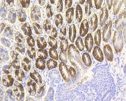Invitrogen Cytokeratin 20 Recombinant Rabbit Monoclonal Antibody (JE20-39)