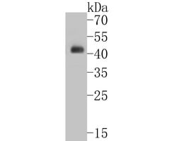 Invitrogen Cytokeratin 20 Recombinant Rabbit Monoclonal Antibody (JE20-39)