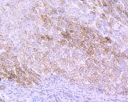 Invitrogen Villin Recombinant Rabbit Monoclonal Antibody (JE39-08) 100