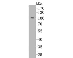 Invitrogen Villin Recombinant Rabbit Monoclonal Antibody (JE39-08) 100