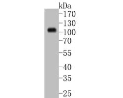 Invitrogen Villin Recombinant Rabbit Monoclonal Antibody (JE39-08) 100