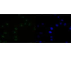 Invitrogen PAX2 Recombinant Rabbit Monoclonal Antibody (JE25-49) 100 &mu;L | Buy Online | Invitrogen&trade; | Fisher Scientific