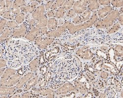 Invitrogen PAX2 Recombinant Rabbit Monoclonal Antibody (JE25-49) 100 &mu;L | Buy Online | Invitrogen&trade; | Fisher Scientific