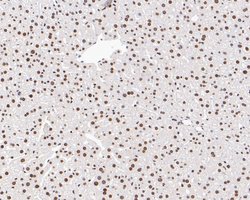 Invitrogen PAX2 Recombinant Rabbit Monoclonal Antibody (JE25-49) 100 &mu;L | Buy Online | Invitrogen&trade; | Fisher Scientific