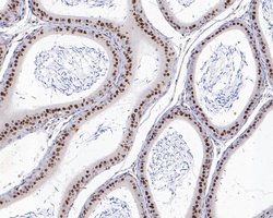 Invitrogen PAX2 Recombinant Rabbit Monoclonal Antibody (JE25-49) 100 &mu;L | Buy Online | Invitrogen&trade; | Fisher Scientific