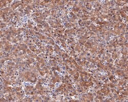 Neurocan Recombinant Rabbit Monoclonal Antibody (JE54-15), Invitrogen 100