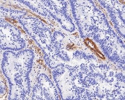 Invitrogen Integrin beta 3 Recombinant Rabbit Monoclonal Antibody (JE22-64)