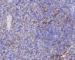 Invitrogen Integrin beta 3 Recombinant Rabbit Monoclonal Antibody (JE22-64)