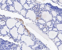 Invitrogen Integrin beta 3 Recombinant Rabbit Monoclonal Antibody (JE22-64)