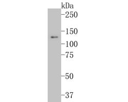 Invitrogen Integrin beta 3 Recombinant Rabbit Monoclonal Antibody (JE22-64)