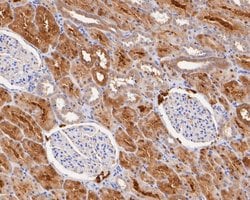Invitrogen Syntaxin 1 Recombinant Rabbit Monoclonal Antibody (JE54-37)