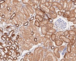 Invitrogen GOT2 Recombinant Rabbit Monoclonal Antibody (JE54-46) 100 &mu;L;