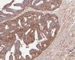 Invitrogen TNFRSF19 Recombinant Rabbit Monoclonal Antibody (JE54-51) 100