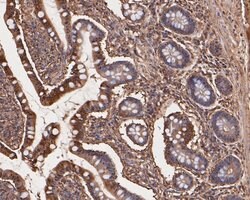 Invitrogen TNFRSF19 Recombinant Rabbit Monoclonal Antibody (JE54-51) 100
