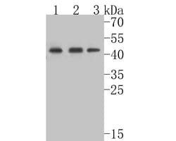 Invitrogen TNFRSF19 Recombinant Rabbit Monoclonal Antibody (JE54-51) 100