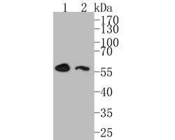 Invitrogen DOK1 Recombinant Rabbit Monoclonal Antibody (JE54-52) 100 &mu;L;