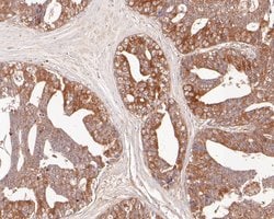 Invitrogen EphB3 Recombinant Rabbit Monoclonal Antibody (JE54-73) 100 &mu;L;
