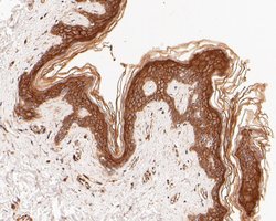 Invitrogen EphB3 Recombinant Rabbit Monoclonal Antibody (JE54-73) 100 &mu;L;