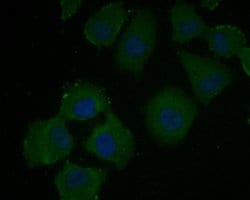 Invitrogen VEGFD Recombinant Rabbit Monoclonal Antibody (JE54-75) 100 &mu;L;