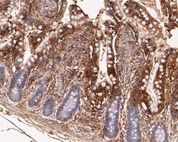 Invitrogen VEGFD Recombinant Rabbit Monoclonal Antibody (JE54-75) 100 &mu;L;