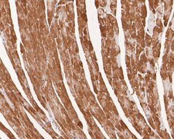 Invitrogen VEGFD Recombinant Rabbit Monoclonal Antibody (JE54-75) 100 &mu;L;