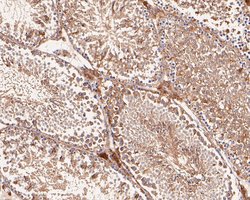 Invitrogen VEGFD Recombinant Rabbit Monoclonal Antibody (JE54-75) 100 &mu;L;