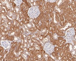 Invitrogen VEGFD Recombinant Rabbit Monoclonal Antibody (JE54-75) 100 &mu;L;