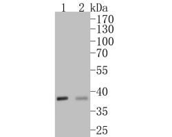 Invitrogen VEGFD Recombinant Rabbit Monoclonal Antibody (JE54-75) 100 &mu;L;