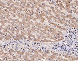 Invitrogen DPYD Recombinant Rabbit Monoclonal Antibody (JE54-79) 100 &mu;L;
