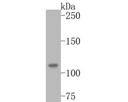 Invitrogen DPYD Recombinant Rabbit Monoclonal Antibody (JE54-79) 100 &mu;L;