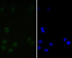 Invitrogen Tat-SF1 Recombinant Rabbit Monoclonal Antibody (JE54-89) 100