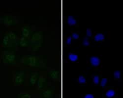 Invitrogen Tat-SF1 Recombinant Rabbit Monoclonal Antibody (JE54-89) 100