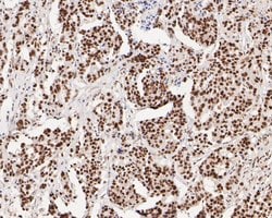 Invitrogen Tat-SF1 Recombinant Rabbit Monoclonal Antibody (JE54-89) 100